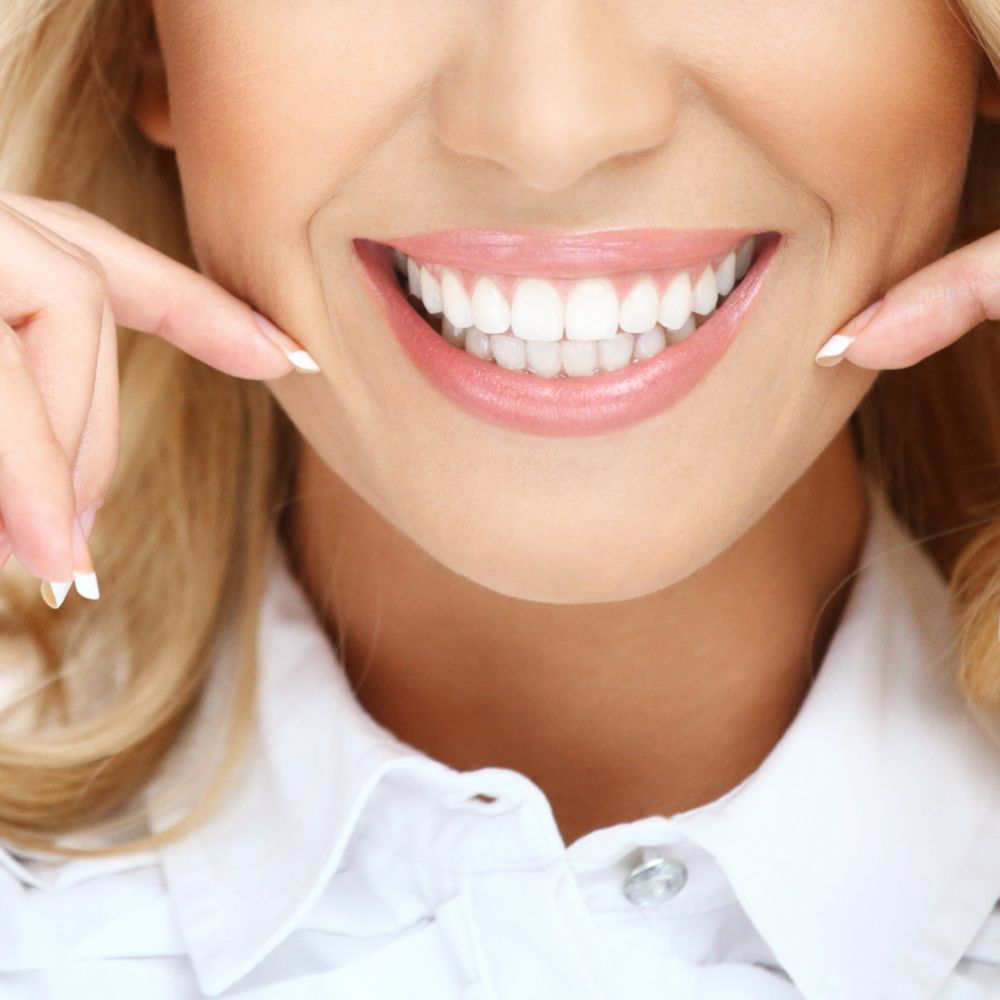The perfect smile after suresmile aligners