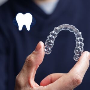 Clear Aligners